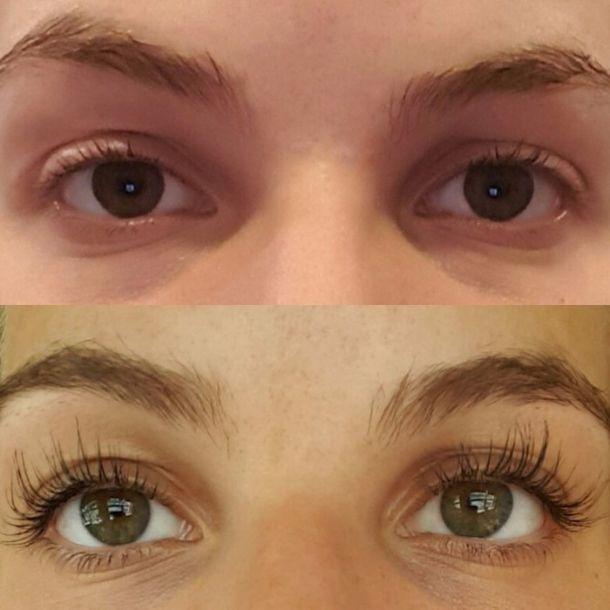  Tolure Hairplus Vippe / Bryn Serum